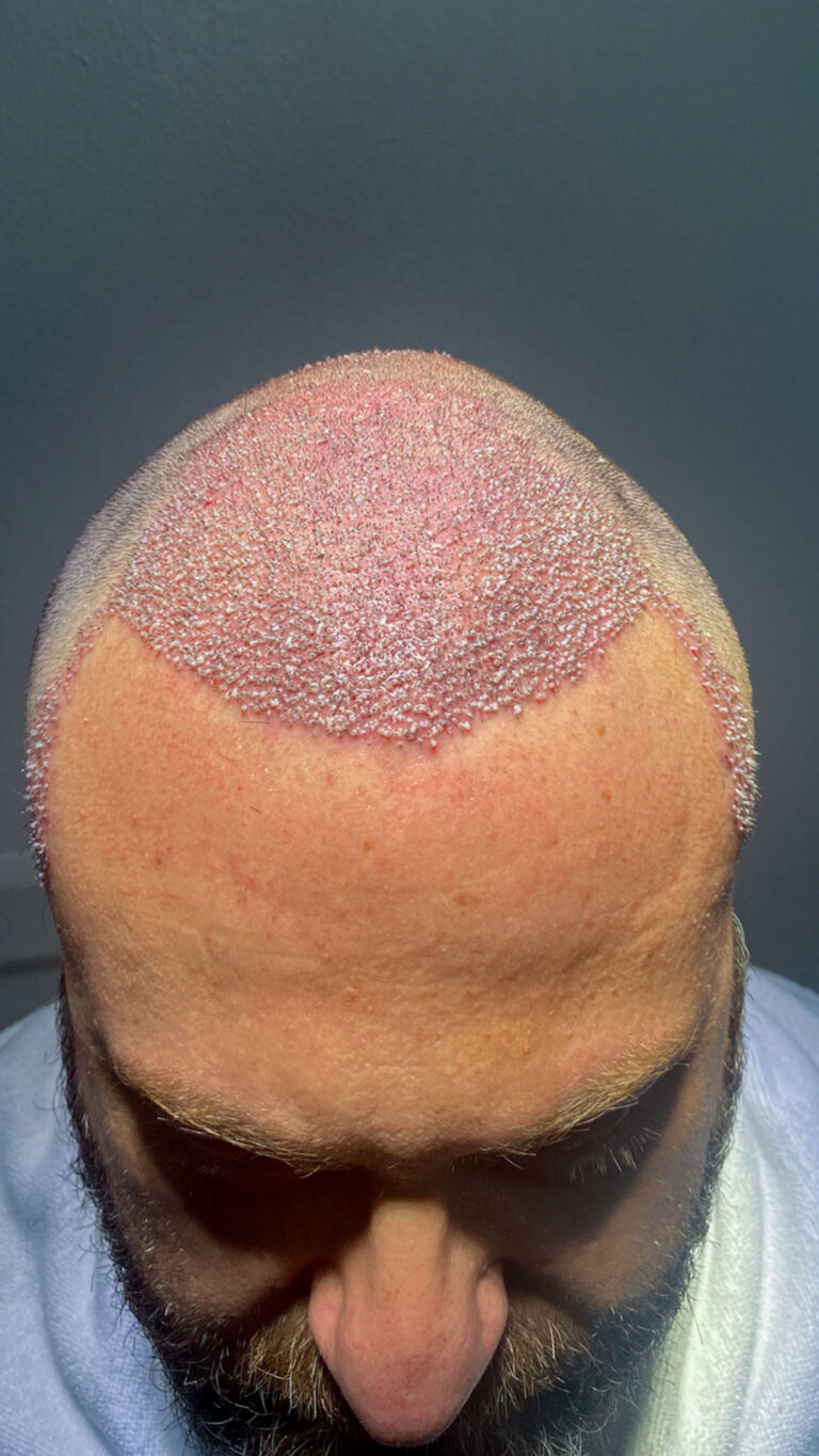 neohair-137-768x1365