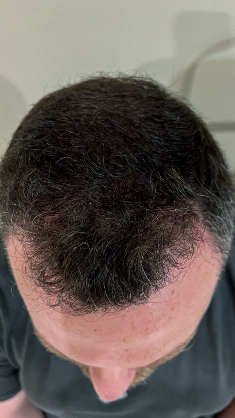 neohair-346-768x1365