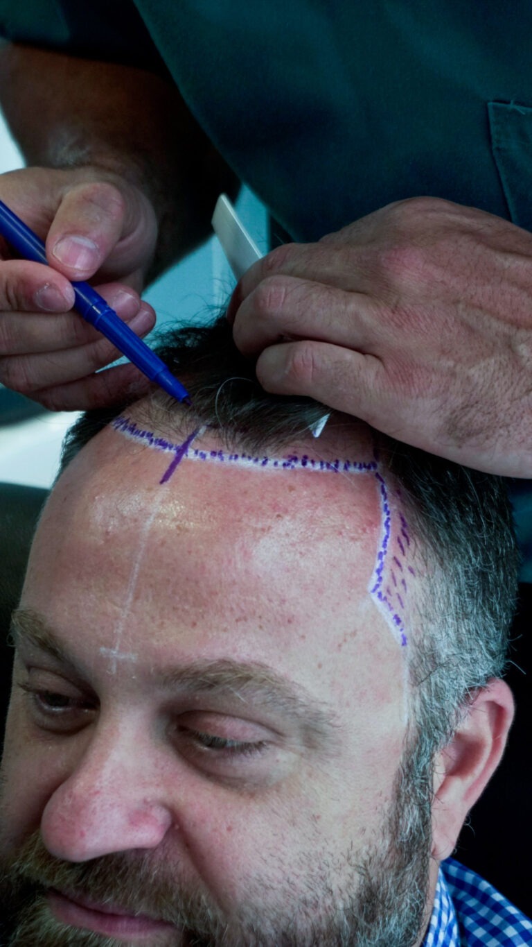 neorhair_images-49-768x1365